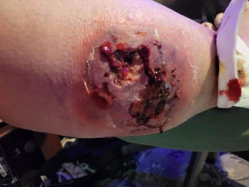 IMG_20230412_203237_241