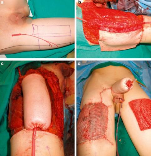 IMG_20230508_235013_412