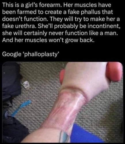 girls forearm