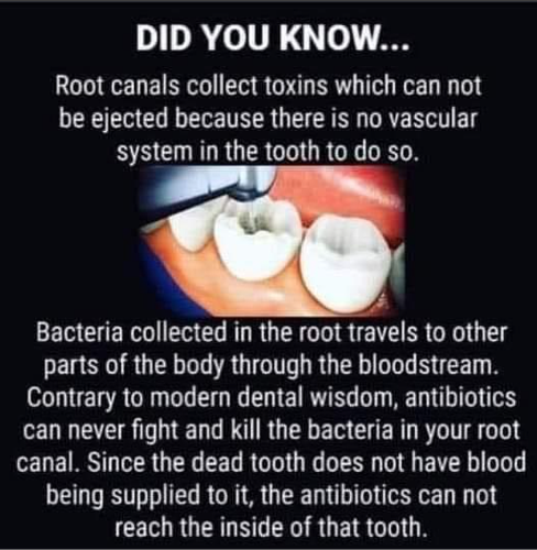 Root canal facts