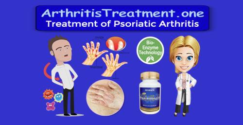 ArthritisTreatment.one - Treatment for Psoriatic Arthritis
