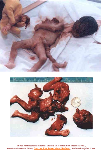 Screenshot_2022-11-04-01-22-42_kindlephoto-239767757