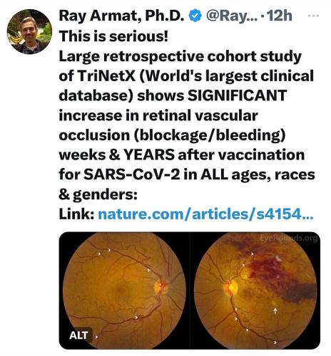 Vaccines and Retinopathy