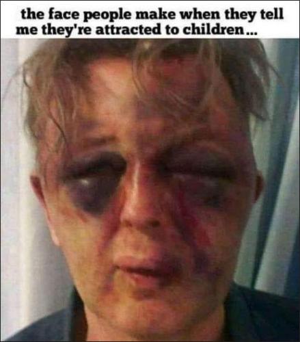 minor attacted person01