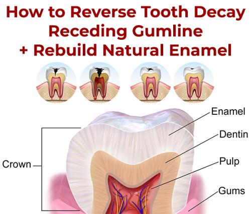 !   Reverse Tooth Decay Build Enamel