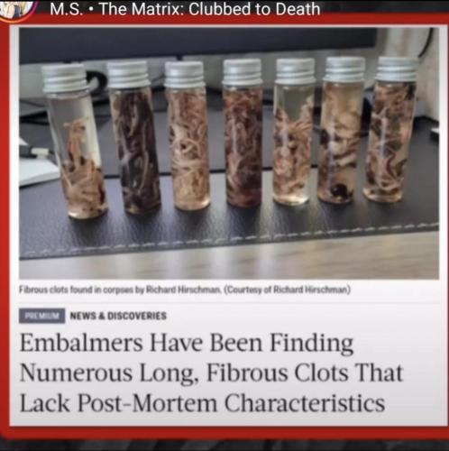 Covid Clots and AIDS