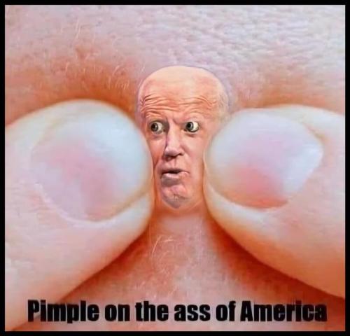 Pimple on the ass of America