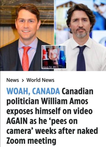 exposes himself again