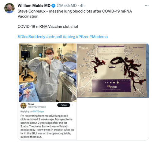 Covid 19 Blood Clots