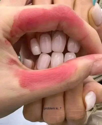 teeth