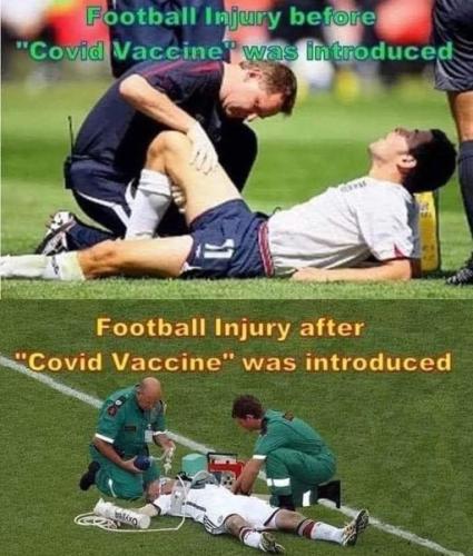 football injury