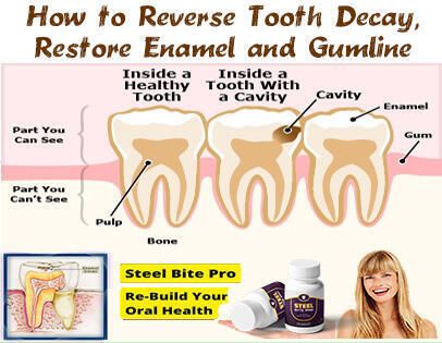 !    How to restore tooth enamel - steel bite pro