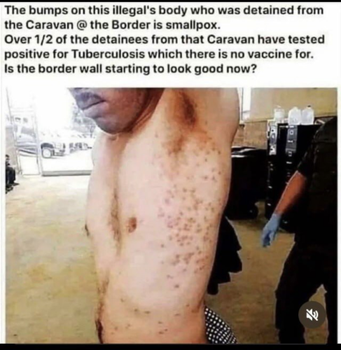 Illegal smallpox