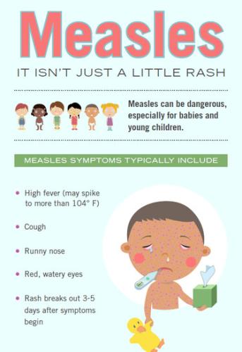 MEASLES6