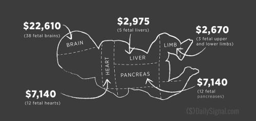 Planned parenthood baby body_parts_for_sale