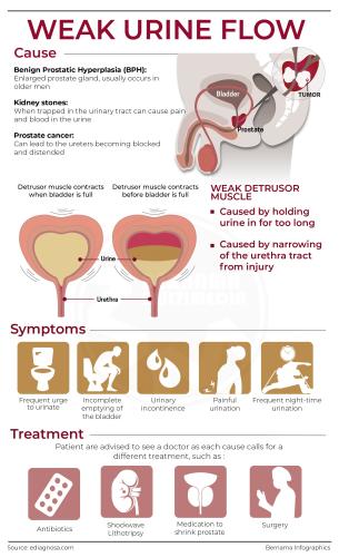 Weak Urine Flow chart pee men