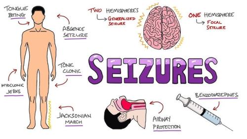 Seizures information