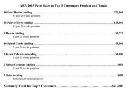 aborted baby body parts