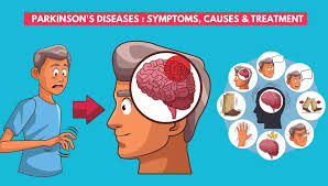 Parkinsons symptoms treatment