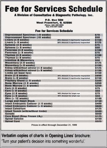 aborted baby fee-schedule