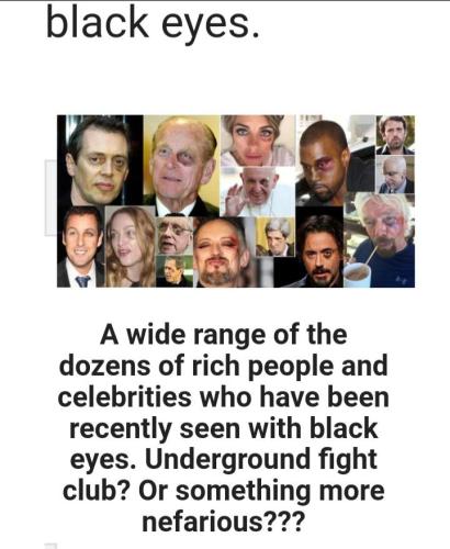 wyt-the-black-eye-club-v0-1jgqzon93crb1