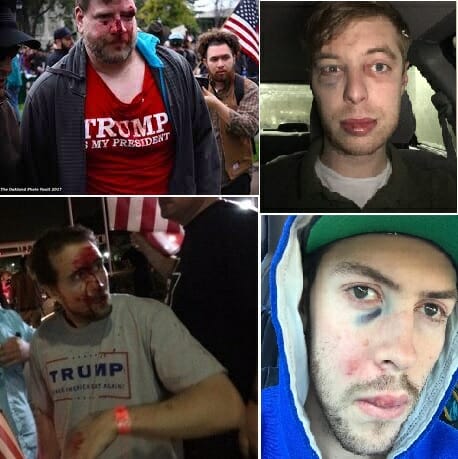 Love trumps hate trump-supporters-beaten-beat-attack-