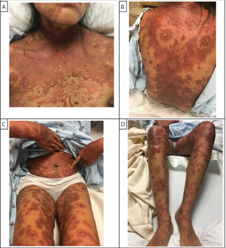 GRmYy2PbMAIj8GA