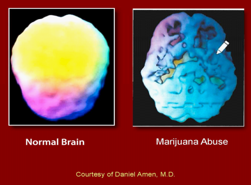 pot your brain on pot2