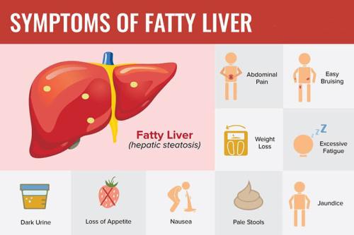 Symptoms of fatty liver disease and treatment