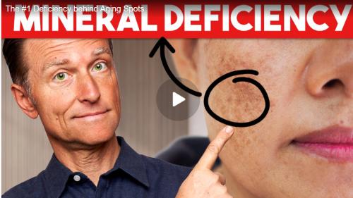 Dr. Berg Mineral deficiency screenshot