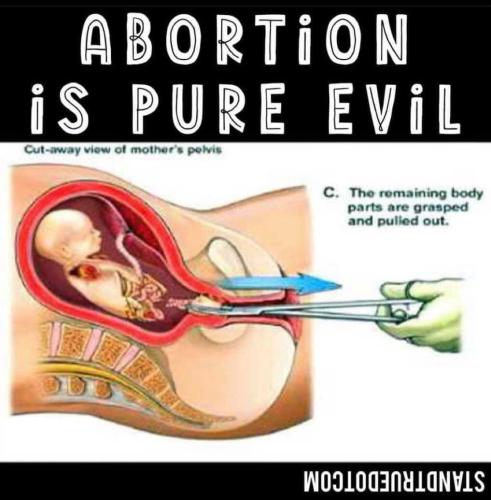 abortion evil me