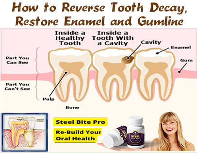 !    How to restore tooth enamel - steel bite pro