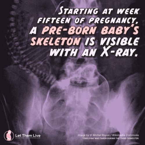 baby skeleton f
