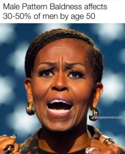 male pattern baldness