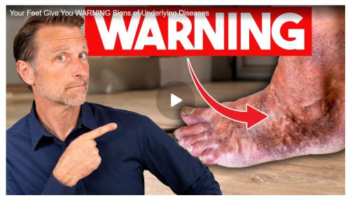 Dr. Berg foot warning