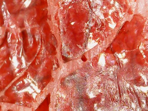 SPINE DRAINAGE AND AIR DRIED RESCABBING (12)