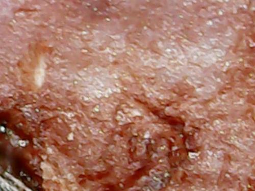 SPINE BASE HYDRO GEL PROGRESS (13)