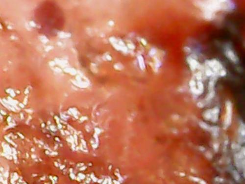 SPINE BASE HYDRO GEL PROGRESS