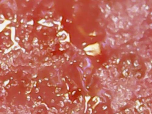 SPINE BASE HYDRO GEL PROGRESS (5)