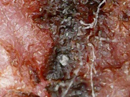 SPINE BASE HYDRO GEL PROGRESS (12)