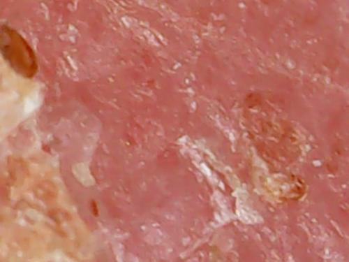 SPINE BASE HYDRO GEL PROGRESS (8)