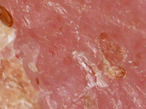 SPINE BASE HYDRO GEL PROGRESS (9)