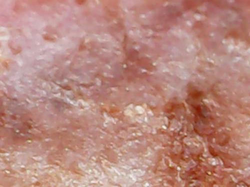 SPINE BASE HYDRO GEL PROGRESS (14)