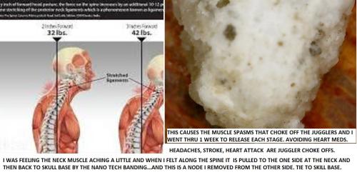 NECK ACHES, HEAD ACHES  AND MUSCLE SPASMS.