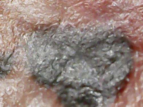 SPINE BASE HYDRO GEL PROGRESS (16)