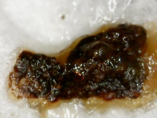 EGG WHITE BLACK SPOT (4)