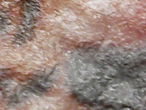 SPINE BASE HYDRO GEL PROGRESS (10)