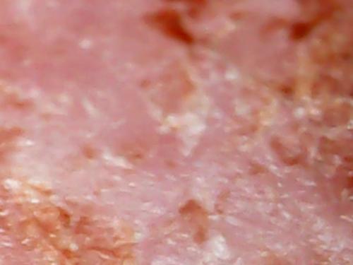 SPINE BASE HYDRO GEL PROGRESS (11)