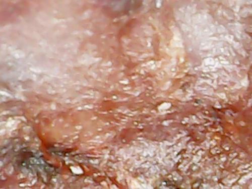 SPINE BASE HYDRO GEL PROGRESS (19)