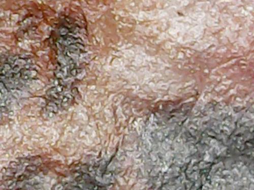 SPINE BASE HYDRO GEL PROGRESS (17)